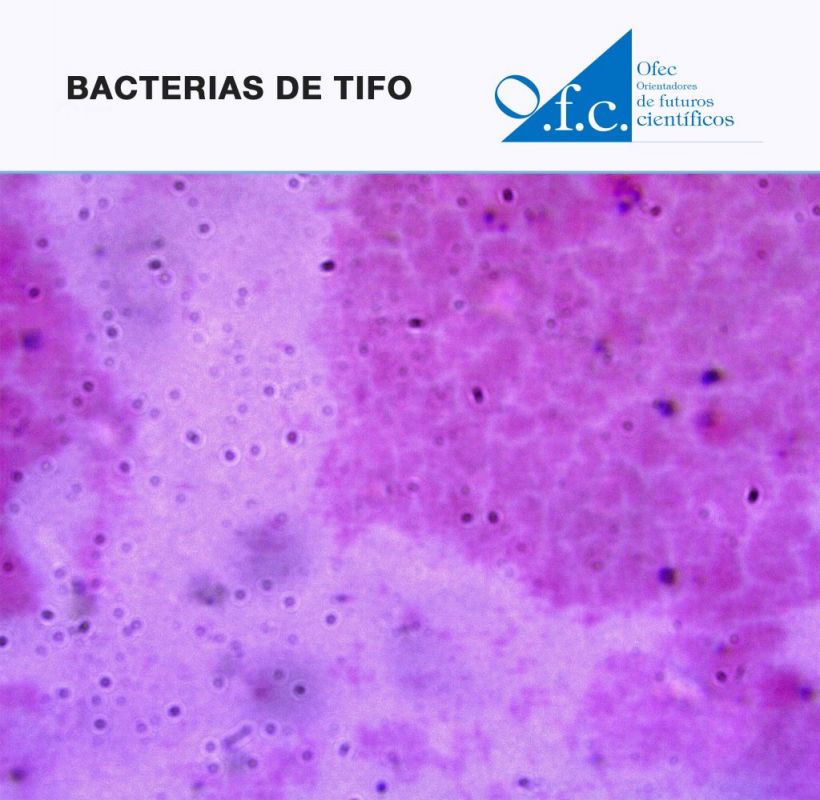 Bacterias de tifo