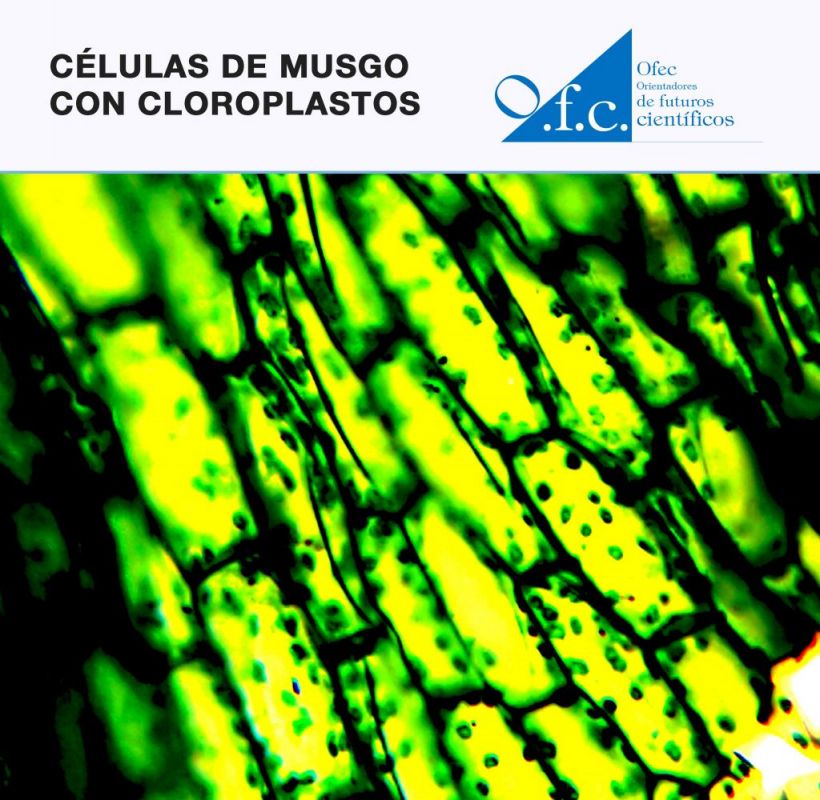 Células de musgo con cloroplastos