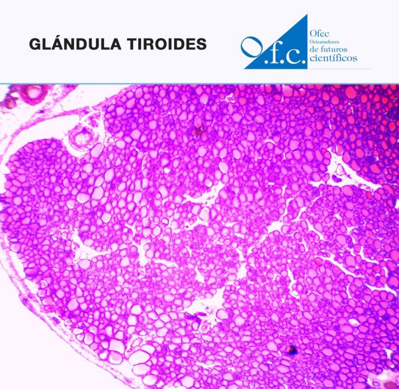 Glándula tiroides