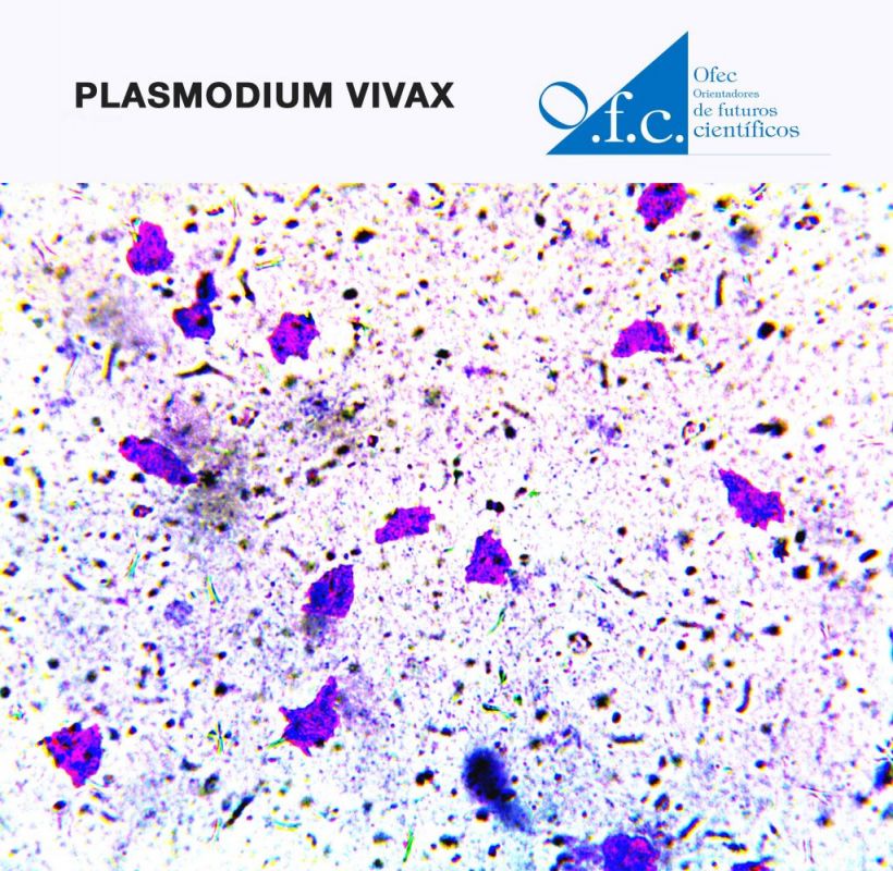 Plasmodium vivax